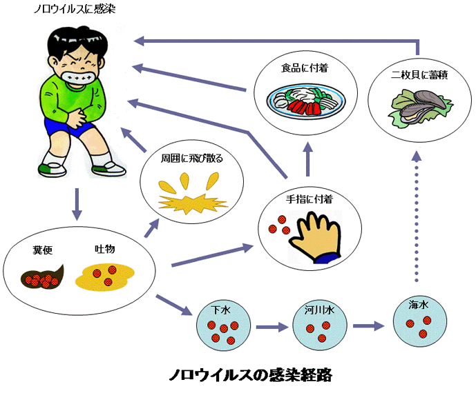 ノロウイルス感染経路
